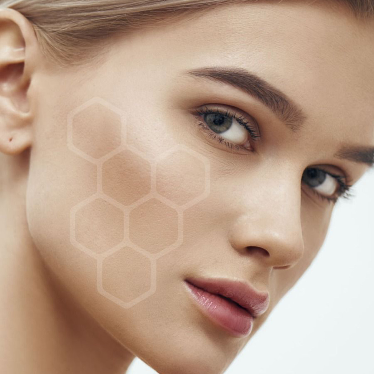 Traitement microneedling