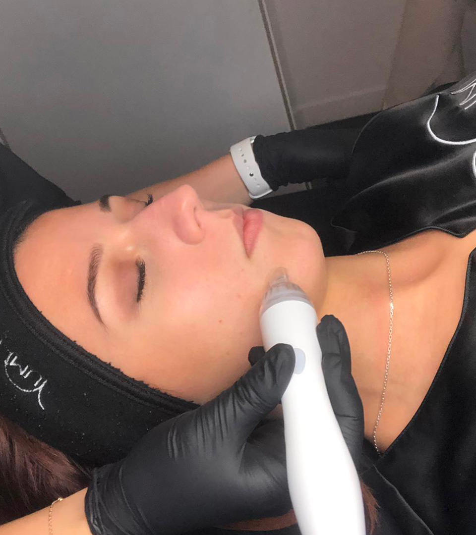 Traitement de microneedling